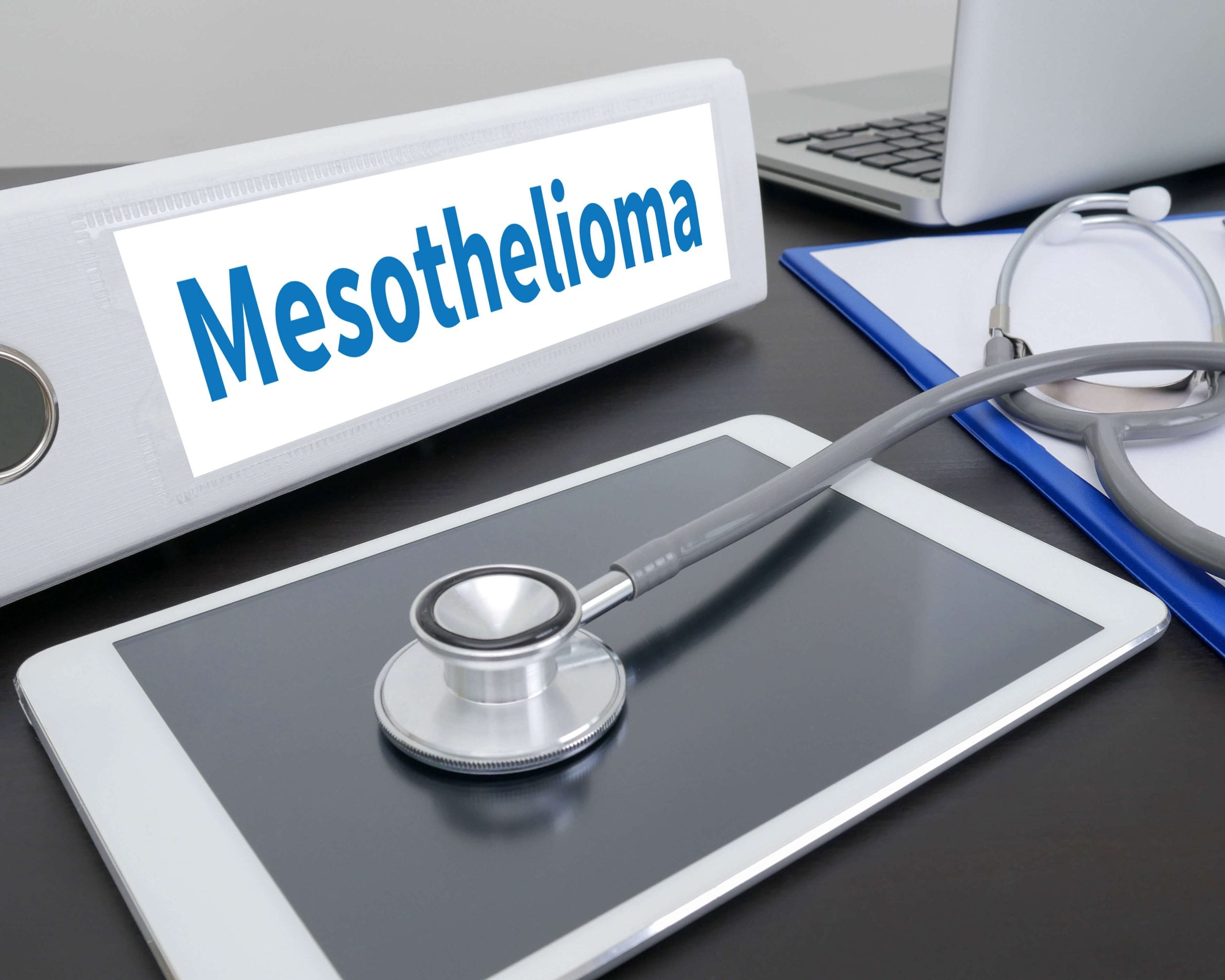 Stages-of-Mesothelioma in Dallas